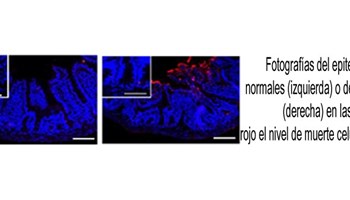 Desvelado un nuevo mecanismo molecular que previene la enfermedad inflamatoria intestinal
