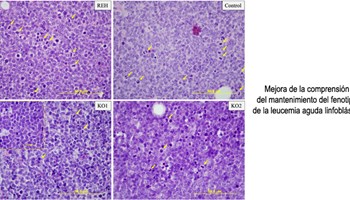Mejora de la comprensión del mantenimiento del fenotipo de la leucemia aguda linfoblástica.