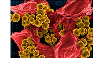 Un estudio muestra que el microbioma intestinal protege frente a la predisposición genética a la leucemia