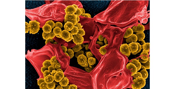 Un estudio muestra que el microbioma intestinal protege frente a la predisposición genética a la leucemia