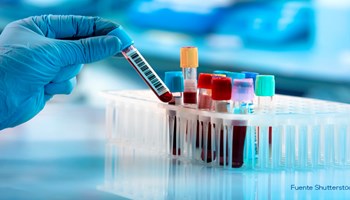 Investigadores del Centro de Investigación del Cáncer desarrollan nueva clasificación pronóstica de la mastocitosis