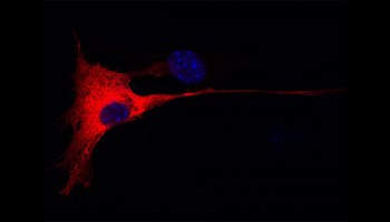 Identificada una proteína que afecta a la eficacia de fármacos dirigidos al gen KRAS