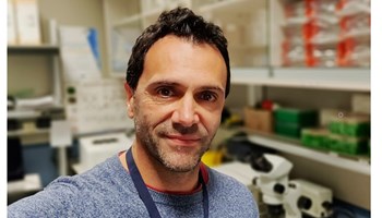 Cellular heterogeneity and Rho GTPase signalling in neuroblastoma tumours