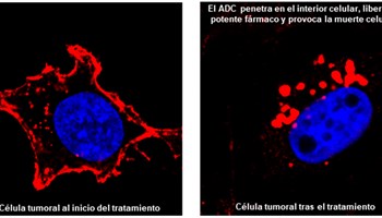 Diseñada una estrategia para identificar dianas terapéuticas en cáncer de mama triple negativo