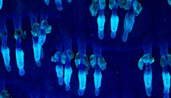 Identificadas dos proteínas que modulan el comportamiento de las células madre de la piel