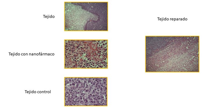 Puesta a punto de caracterización de nanofármacos y sus aplicaciones en inmunoterapia oncológica
