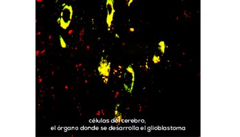Desarrollan una nueva herramienta informática para analizar con más detalle las alteraciones genéticas del genoma de las células cancerosas