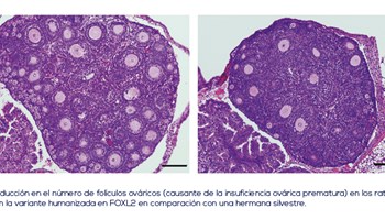 La mutación de un solo gen desencadena el desarrollo de un tipo de cáncer de ovario