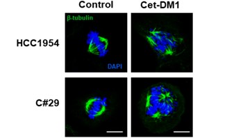 Identificada una nueva diana para tratamiento de cáncer de mama HER2 positivo con resistencia a T-DM1.