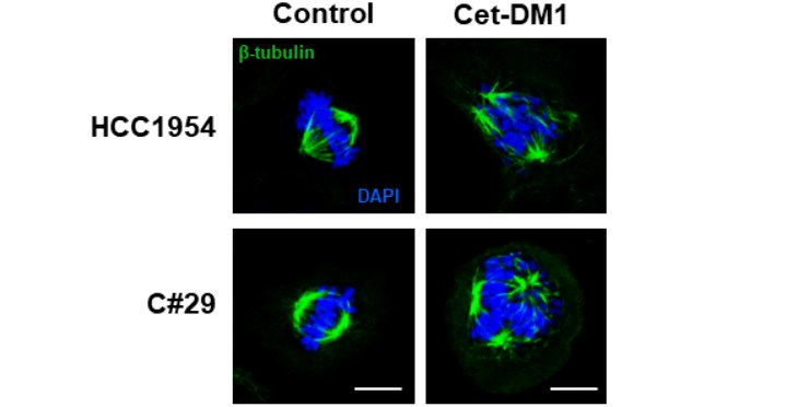 Identificada una nueva diana para tratamiento de cáncer de mama HER2 positivo con resistencia a T-DM1.