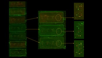 Diseñado y desarrollado un chip que permite realizar diagnóstico precoz de patologías articulares