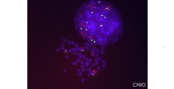 Identificados los mecanismos que provocan la resistencia al tratamiento de cáncer de pulmón con Sotorasib, el primer inhibidor de KRAS
