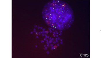 Identificados los mecanismos que provocan la resistencia al tratamiento de cáncer de pulmón con Sotorasib, el primer inhibidor de KRAS