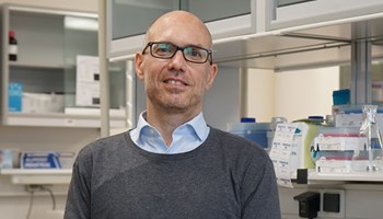 KRAS oncogene copy numbers regulate lung tumor formation and response to therapy