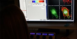 Día Mundial de la Investigación del Cáncer 2023