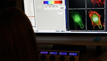 Día Mundial de la Investigación del Cáncer 2023