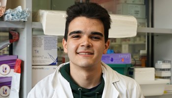 Exploring the role of senescence induced by CDK4/6 inhibitors in resistance to breast cancer treatment.