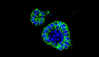 Un nuevo fármaco frente a un transportador de aminoácidos es efectivo en cáncer de colon