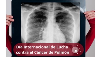 Día Internacional de Lucha contra el Cáncer de Pulmón. Cómo se investiga el cáncer de pulmón en el Centro de Investigación del Cáncer