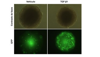 El Centro de Investigación del Cáncer incorpora una nueva línea de investigación sobre cáncer hepático