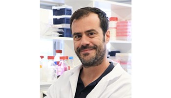 Uncovering the role of flavin-containing monooxygenase 4 in lung adenocarcinoma: a new protector against ferroptosis