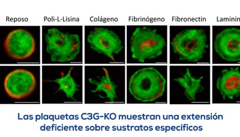 La proteína C3G en plaquetas podría ser un indicador de malignidad de un tumor.