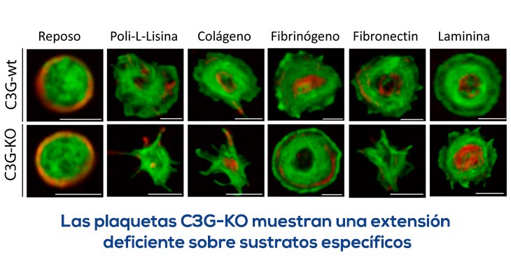 La proteína C3G en plaquetas podría ser un indicador de malignidad de un tumor.