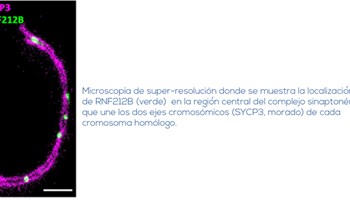 Revelado el papel esencial de una proteína en la meiosis de mamíferos y la estabilidad genómica