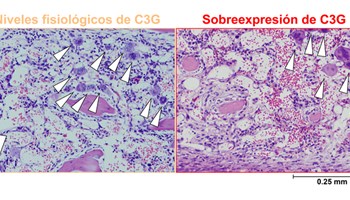 Descubrimiento sobre la proteína C3G y su impacto en la regeneración hematopoyética