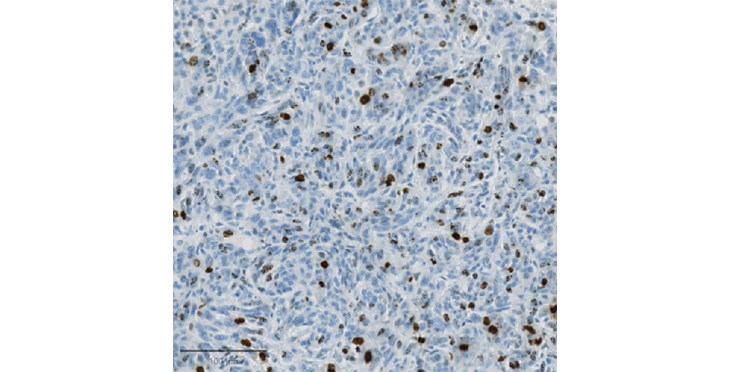 La duración de la división celular es un marcador clave para la susceptibilidad al cáncer