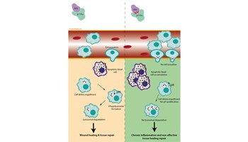 Descubierto un nuevo mecanismo en los macrófagos clave en la resolución de la inflamación