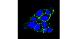 El Centro de Investigación del Cáncer de Salamanca lidera un estudio acerca de una nueva terapia dirigida contra el cáncer de páncreas