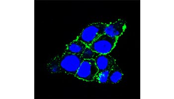 El Centro de Investigación del Cáncer de Salamanca lidera un estudio acerca de una nueva terapia dirigida contra el cáncer de páncreas