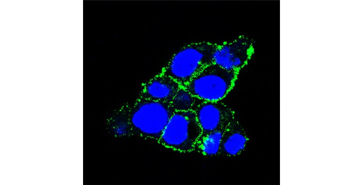 El Centro de Investigación del Cáncer de Salamanca lidera un estudio acerca de una nueva terapia dirigida contra el cáncer de páncreas