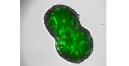 Un avance internacional liderado por el Centro de Investigación del Cáncer abre nuevas vías terapéuticas para el colangiocarcinoma