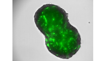 Un avance internacional liderado por el Centro de Investigación del Cáncer abre nuevas vías terapéuticas para el colangiocarcinoma