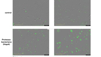 Colaboración internacional liderada por el Centro de Investigación del Cáncer revela un mecanismo bacteriano capaz de destruir células tumorales