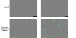 Colaboración internacional liderada por el Centro de Investigación del Cáncer revela un mecanismo bacteriano capaz de destruir células tumorales