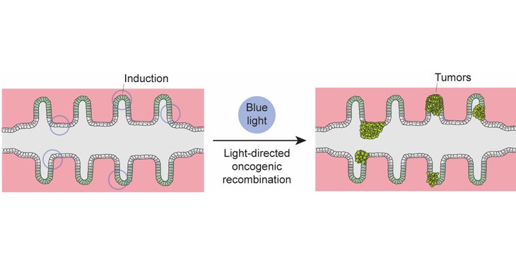 Mini-cólones bioartificiales para ver nacer el cáncer de colon en el laboratorio