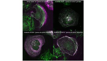 Descubren cómo las mutaciones en el gen MYH9 dictan la gravedad de enfermedades raras de la sangre