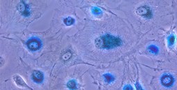 El Centro de Investigación del Cáncer reúne en Salamanca a expertos internacionales para abordar el papel de la senescencia celular en el envejecimiento y el cáncer