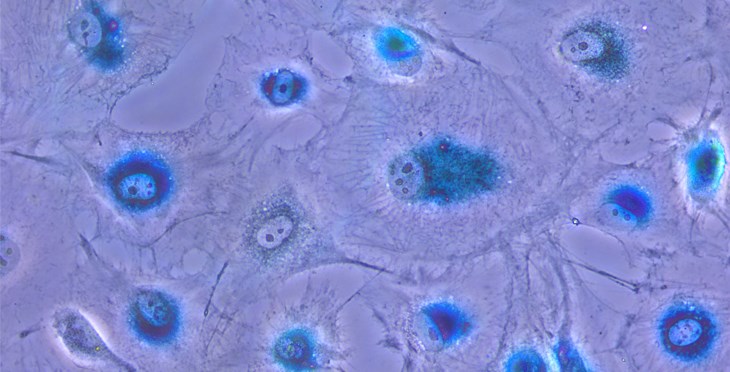 El Centro de Investigación del Cáncer reúne en Salamanca a expertos internacionales para abordar el papel de la senescencia celular en el envejecimiento y el cáncer