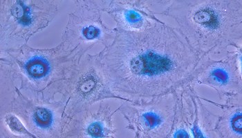 El Centro de Investigación del Cáncer reúne en Salamanca a expertos internacionales para abordar el papel de la senescencia celular en el envejecimiento y el cáncer