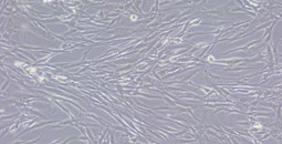 Nuevo mecanismo para vencer la resistencia a la quimioterapia en el cáncer de vías biliares intrahepático.
