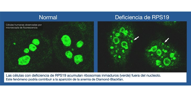 Defectos en la fabricación de los ribosomas revelan un mecanismo común que ayuda a explicar enfermedades raras de la sangre