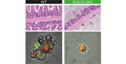 Investigadores del CIC identifican proteínas esenciales para proteger el intestino frente a infecciones graves