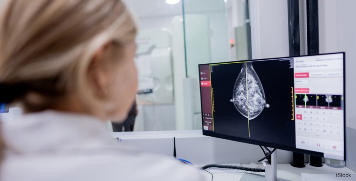 Un fármaco utilizado en el posparto podría reducir el  riesgo de cáncer de mama